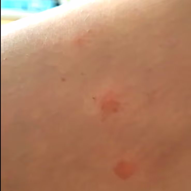 Trusted House Sitting Conflict Resolution. Flea Bites