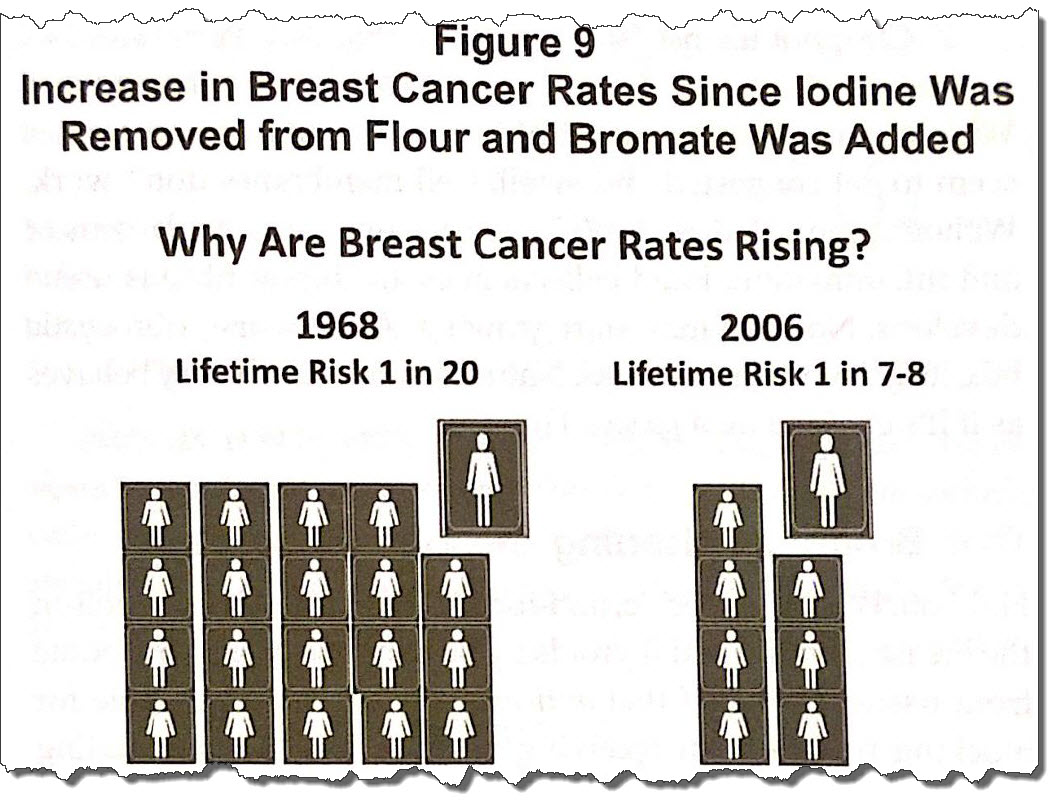 Talking about Iodine, breast cancer and energy