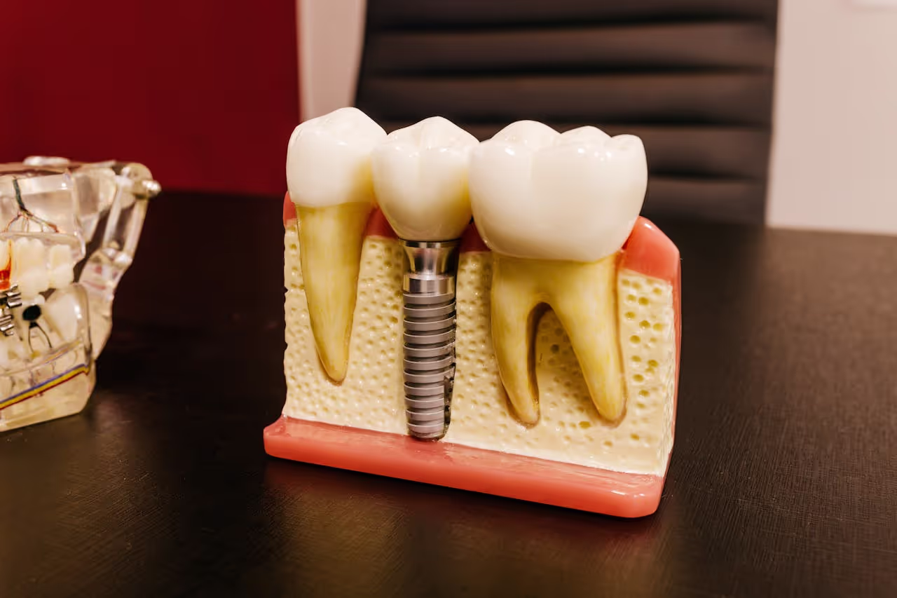 Close up of a dental implant model on a professional workspace desk